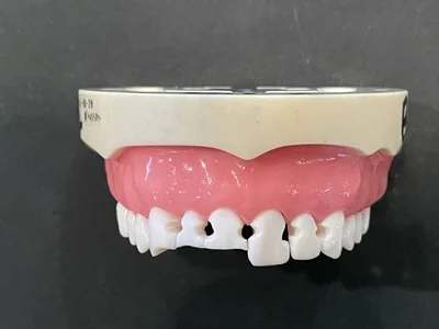 Before Bioclear treatment