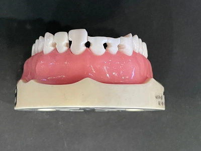 Before Bioclear treatment